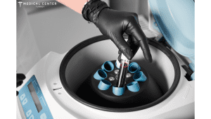 How To Maximize Hair Transplant Results?