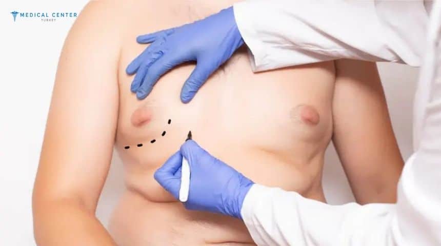 Gynecomastia Surgery in Turkey