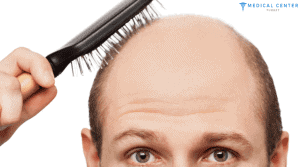 How Minoxidil Works?