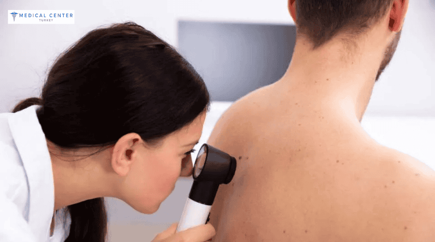 Skin Cancer Treatment in Turkey