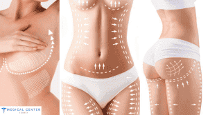 Cheap Mommy Makeover