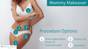 Cheap Mommy Makeover