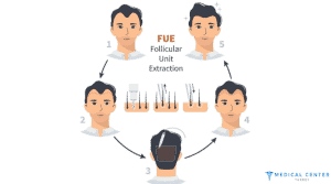 How Much Is Hair Transplant In Turkey 2023?