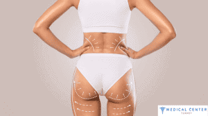 How Much Is a Brazilian Buttock Lift Cost 