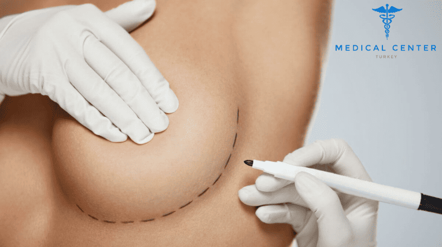 How Often Should Breast Implants Be Replaced