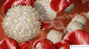 How Successful is Leukemia Treatment