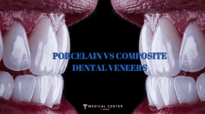 Are Veneers Bad For Your Teeth?