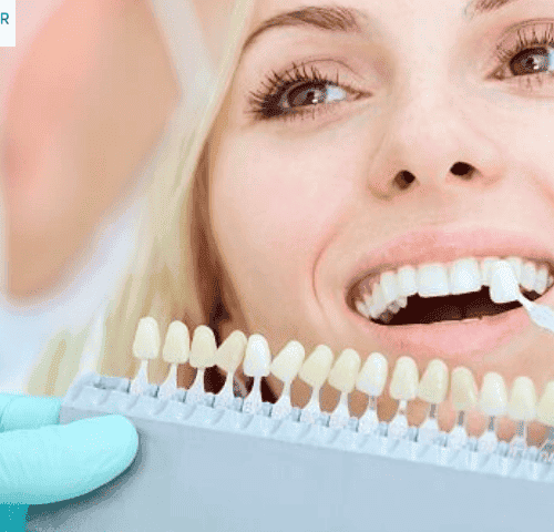 Are Veneers Bad For Your Teeth?