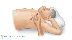 Gynecomastia Pinch Test