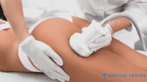 How Much Does Liposuction and A Tummy Tuck Cost