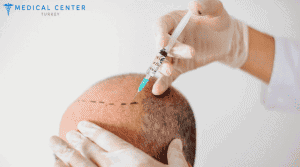 Hair Transplantation in Turkey: Types, Prices, Procedures