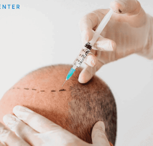 Hair Transplantation in Turkey: Types, Prices, Procedures