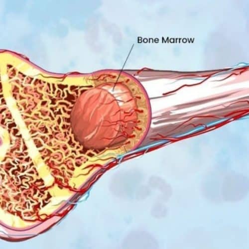 How Long is Bone Marrow Transplant? How Long is Bone Marrow Transplant?