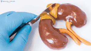 What Is Adrenal Cancer and How It Is Treated?