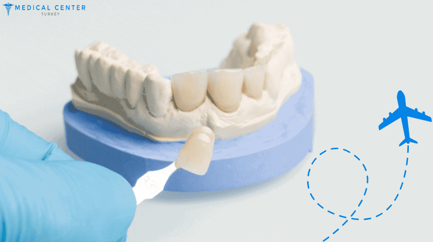 The 9 Best Countries for Veneers