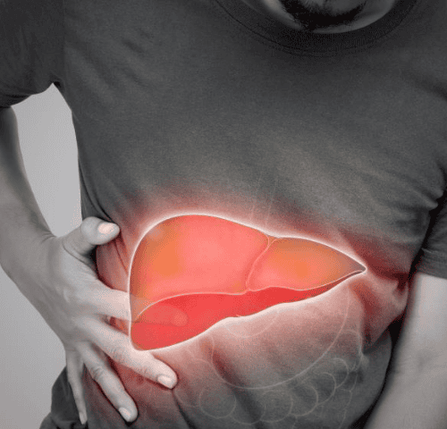 Liver Disease Liver Disease