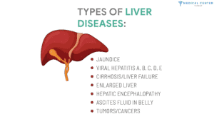 Liver Disease