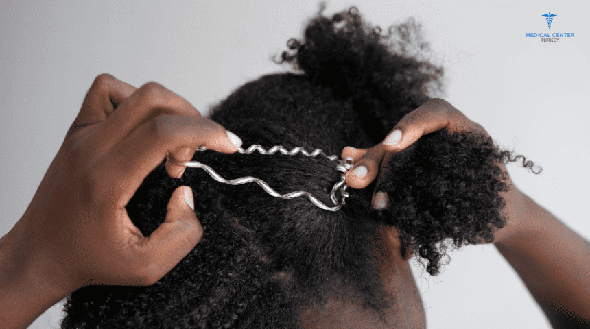 Afro hair transplantation