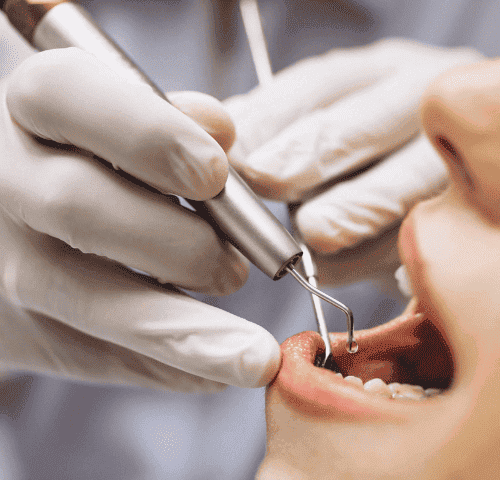What is Restorative Dentistry?