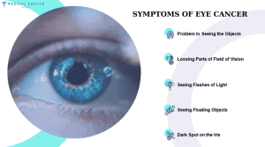 Symptoms of eye cancer
