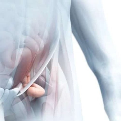 Bilateral Inguinal Hernia Surgery Bilateral Inguinal Hernia Surgery