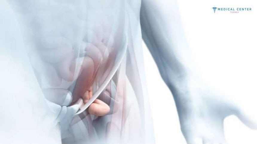 Bilateral Inguinal Hernia Surgery