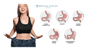 the best and cheapest weight loss surgery by country 3