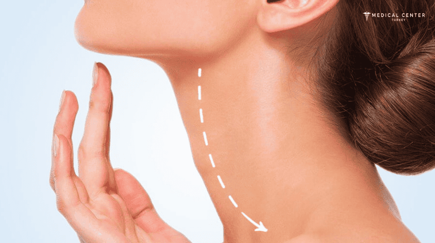 Neck Lift Cost in Turkey