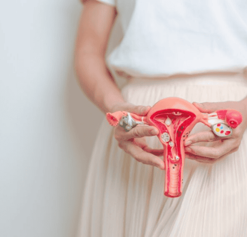 Ovarian Cancer in Turkey Ovarian Cancer in Turkey