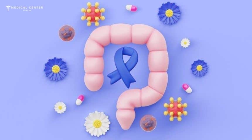 Radiation Therapy for Colorectal Cancer Radiation Therapy for Colorectal Cancer