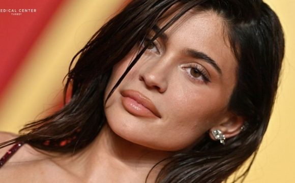 The Secret of Kylie Jenner's Lips