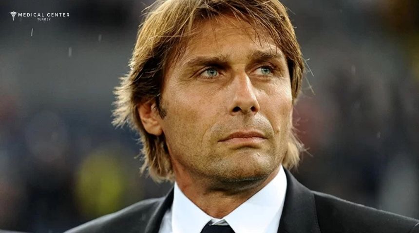 Antonio Conte's Hair Transplantation