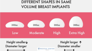 Understanding Breast Implants: Types, Sizes and Placement Options
