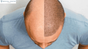 NATURAL HAIR GROWTH METHODS