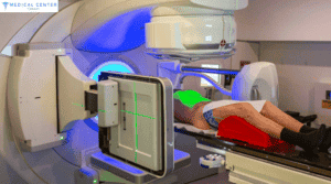 Radiotherapy for Prostate Cancer