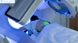 RADIATION THERAPY FOR COLORECTAL CANCER