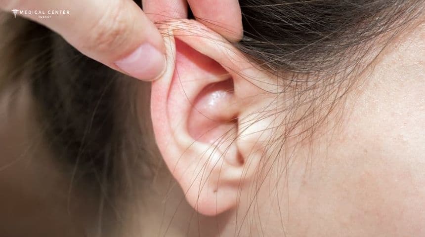 Ear Correction Surgery Cost in Turkey