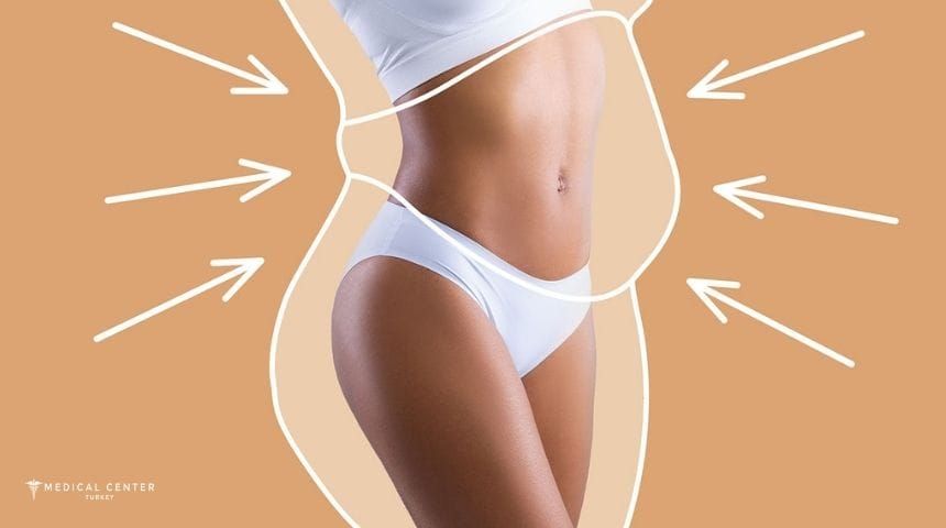 Best Countries for Liposuction