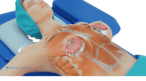 Is Boob Job Painful? 