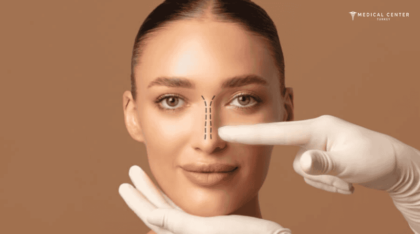 How Much is Nose Job in Turkey? How Much is Nose Job in Turkey?
