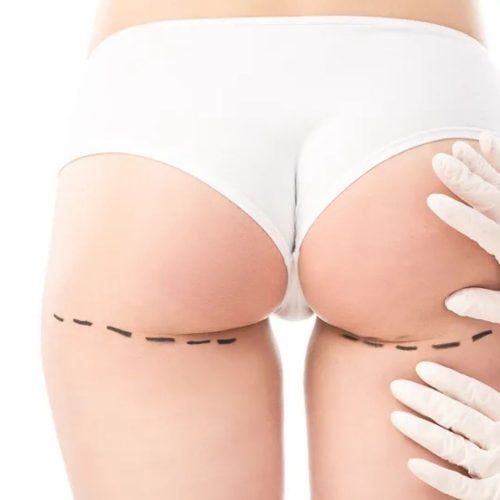 Which is the Best Hospital for Butt Lift in Turkey?