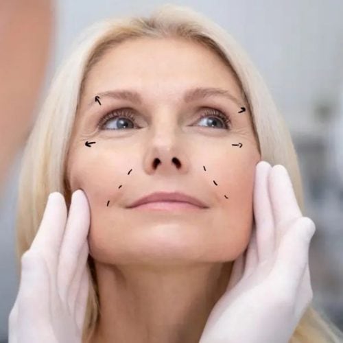 Facelift Healing Time Facelift Healing Time