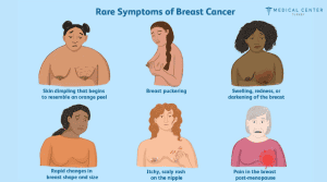 What are the Symptoms of Cancer 