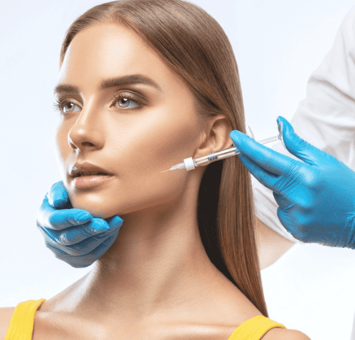 Cheekbone Fillers Cheekbone Fillers