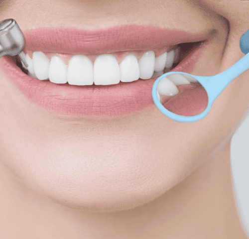 Dental Treatment Guide in Turkey