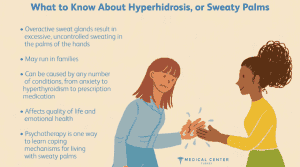 Botox for Hand Sweat 