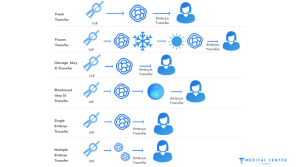 Healthy Babies: Embryo Transfer in Turkey