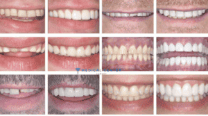 Dentistry in Turkey 