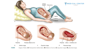 Is it Healthy to Give Birth at Home 