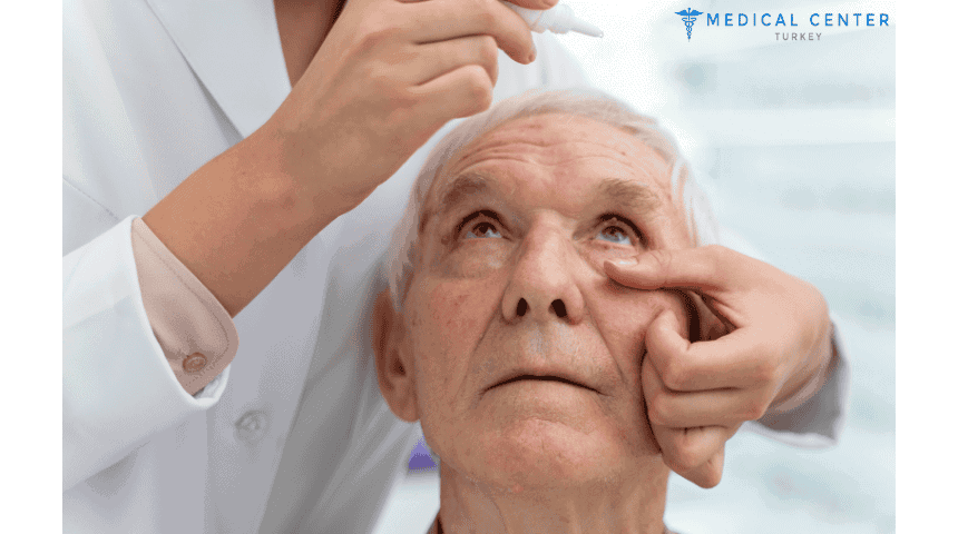 Cataract Surgery in Turkey